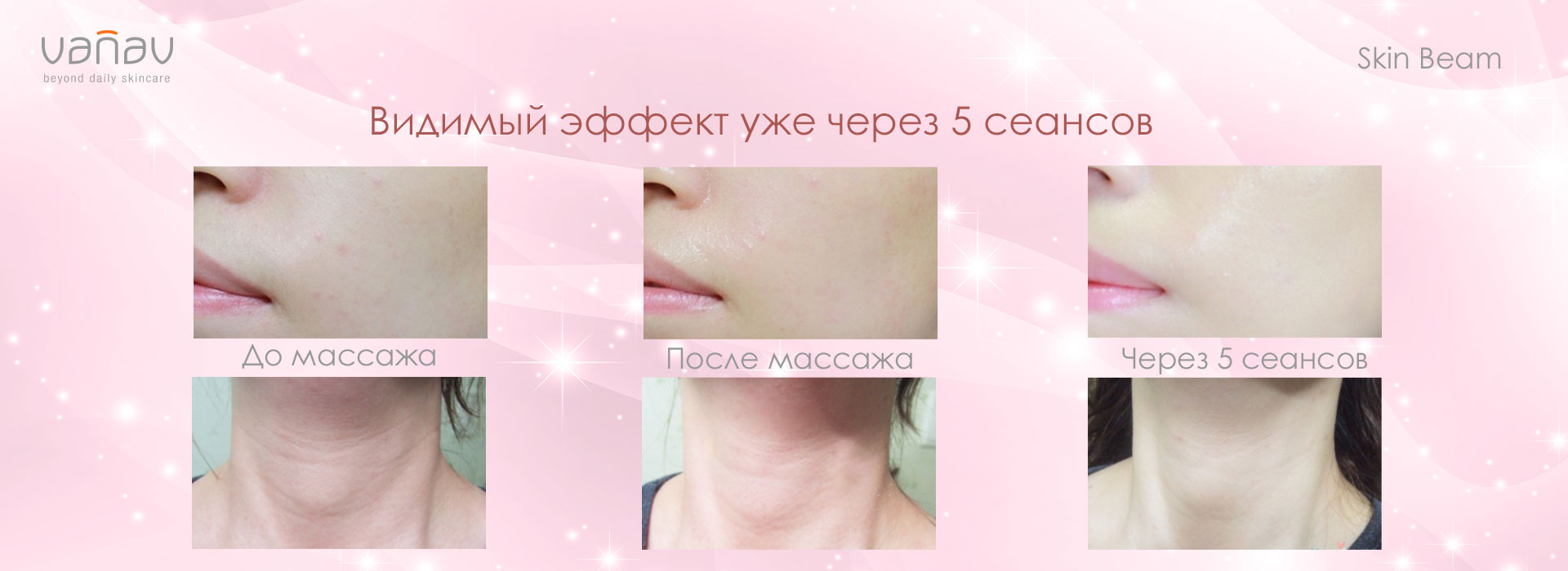 VANAV Skin Beam купить в Красноярске